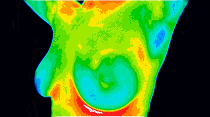 تصویر برداری حرارتی به همراه نرم افزار تشخیصی کارآیی غربالگری سرطان پستان را نشان می دهد
