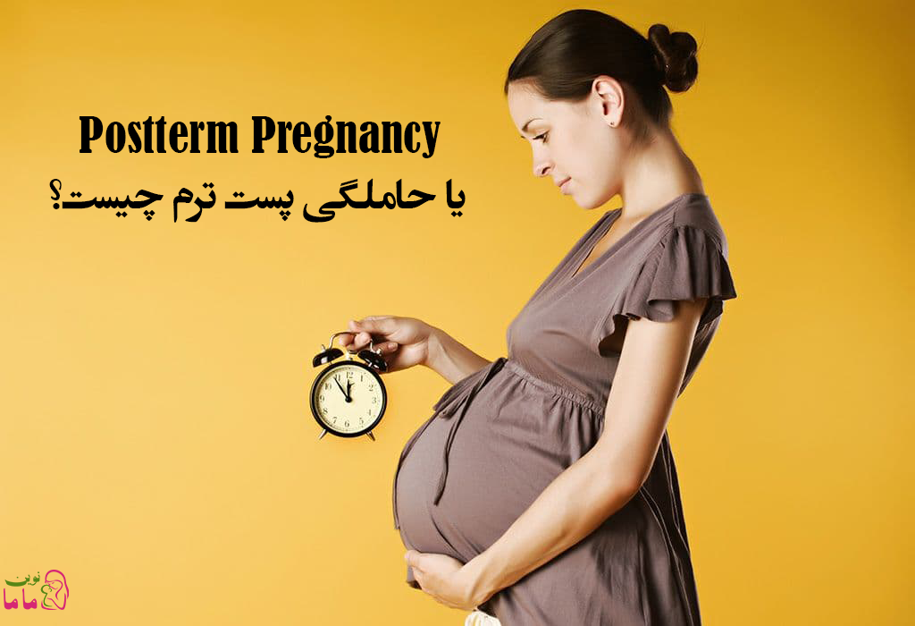 Postterm Pregnancy يا حاملگی پست ترم چیست؟