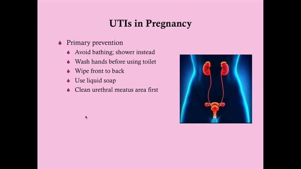 عفونت ادراری (UTI) در زنان