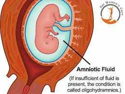 amuiotic fluide index (AFI)