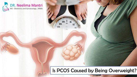 علائم و نشانه های PCOS معمولا در افراد چاق تر شدیدترهستند.