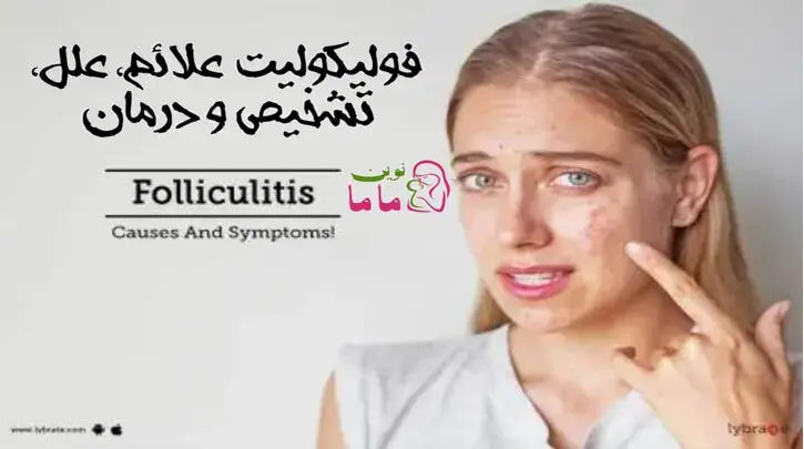  فولیکولیت علائم، علل، تشخیص و درمان