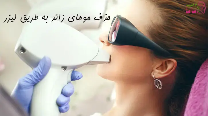 حذف موهای زائد به طریق لیزر