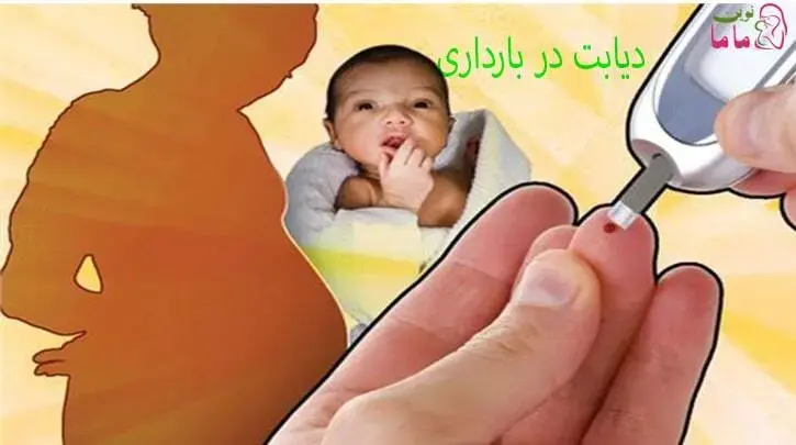 دیابت در بارداری