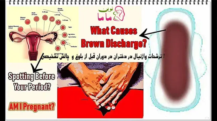 تشخیص ترشحات واژنیال در دختران قبل از بلوغ