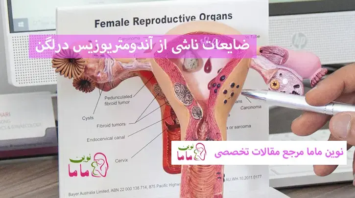 ضایعات ناشی از آندومتریوزیس درلگن ممکن است به شکل نوک کوه یخ باشند