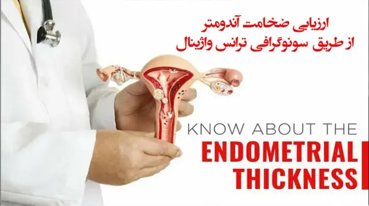 ارزیابی ضخامت آندومتر از طریق سونوگرافی ترانس واژینال