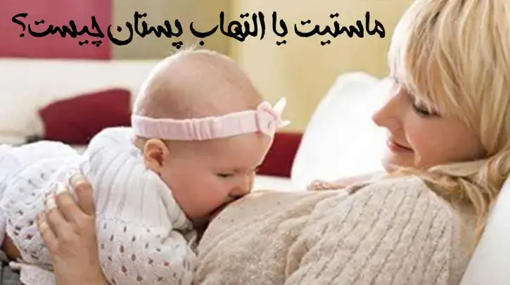 ماستیت (التهاب پستان) چیست؟