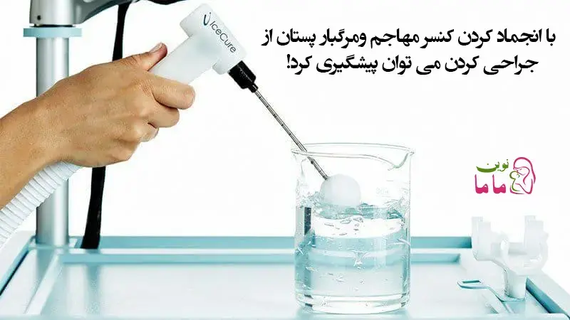 با انجماد کردن برای توقف تکثیر سلولی سرطان پستان از جراحی کردن می توان پیشگیری کرد!