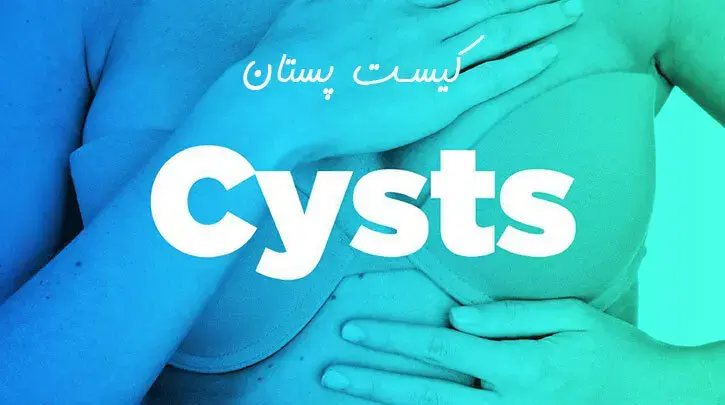 کیست پستانی چیست؟