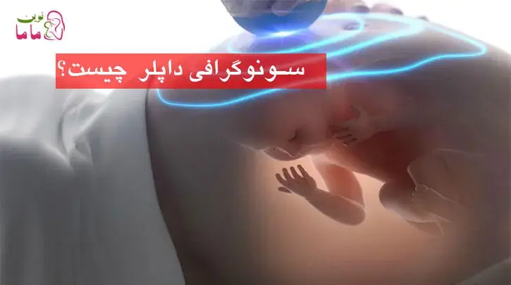 سونوگرافی داپلر
