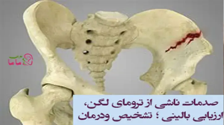 صدمات ناشی از ترومای لگن، ارزیابی بالینی؛ تشخیص ودرمان 