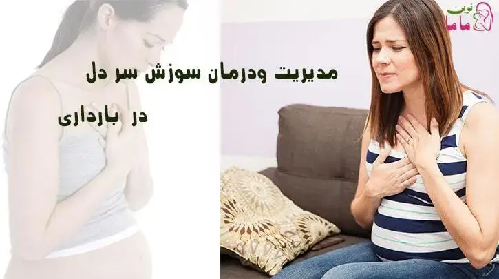 مدیریت و درمان سوزش سر دل در بارداری