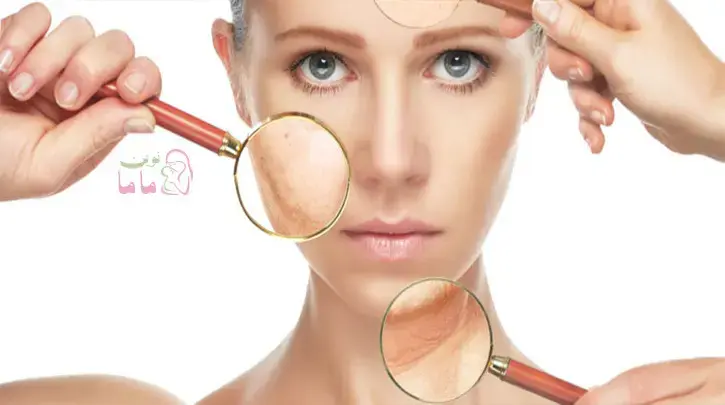 تغییرات پوستی شایع در طول بارداری