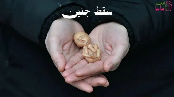 سقط جنین
