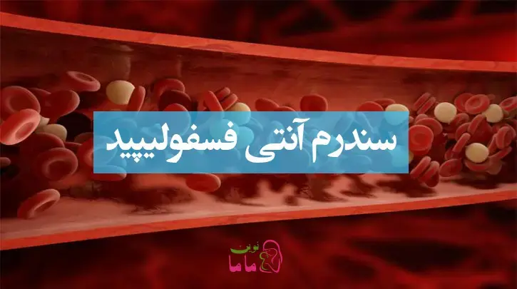 سندرم آنتی فسفولیپید