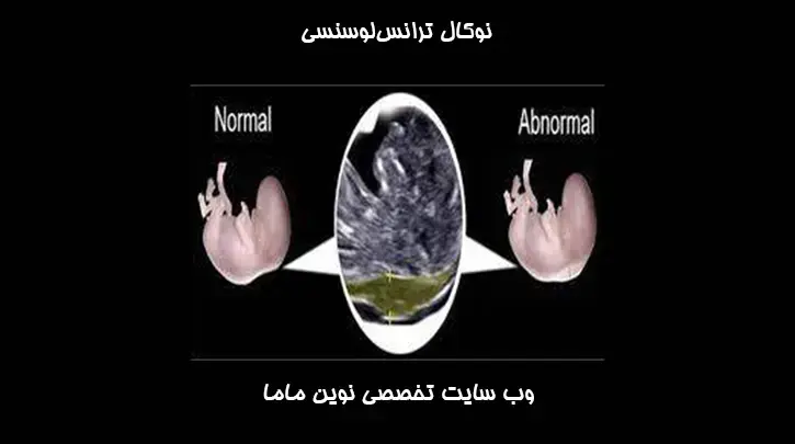 نوکال ترانس‌لوسنسی