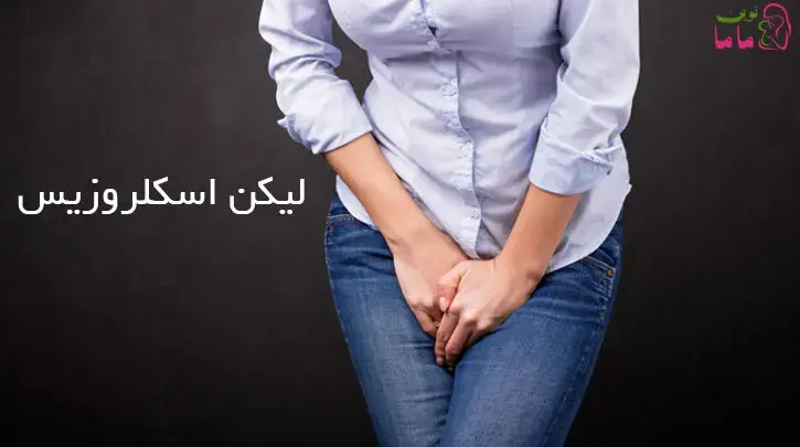 لیکن اسکلروزیس