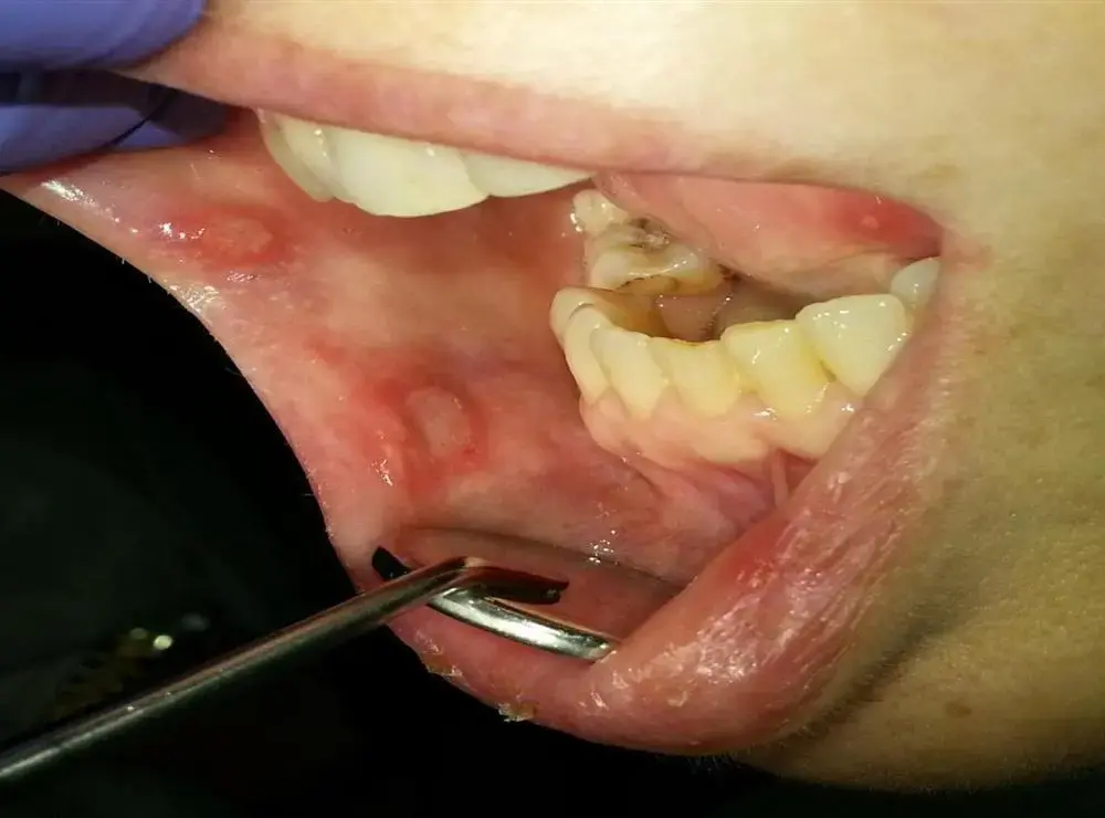 ملاحظات رویکردی