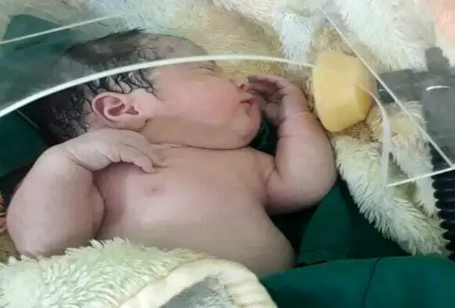 از 72 نوزاد تازه متولد شده تحت آزمایش COVID-19 طی شش ساعت پس از تولد ، 4٪ از نظر ویروس مثبت بودند.