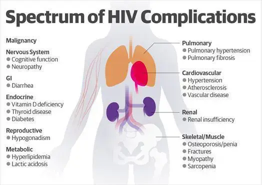 HIV