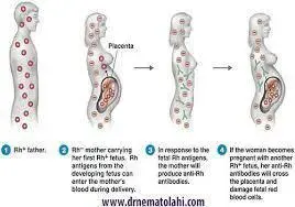 آمپول روگام